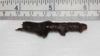 Illustration de l'article : Les vétérinaires sont face à une opération délicate : ils doivent retirer un bâton de 5cm logé dans l’œil d’un chien sans lui faire perdre la vue 