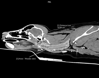 Illustration de l'article : Cette chienne a vécu avec un bâton coincé dans la gorge pendant 6 semaines !