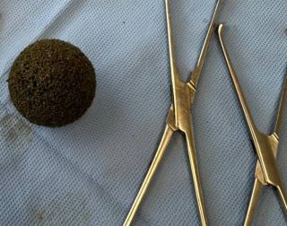 Illustration de l'article : Une agréable balade sur la plage termine par un tour aux urgences pour cette femme et sa chienne